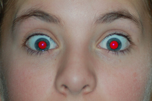 red eye